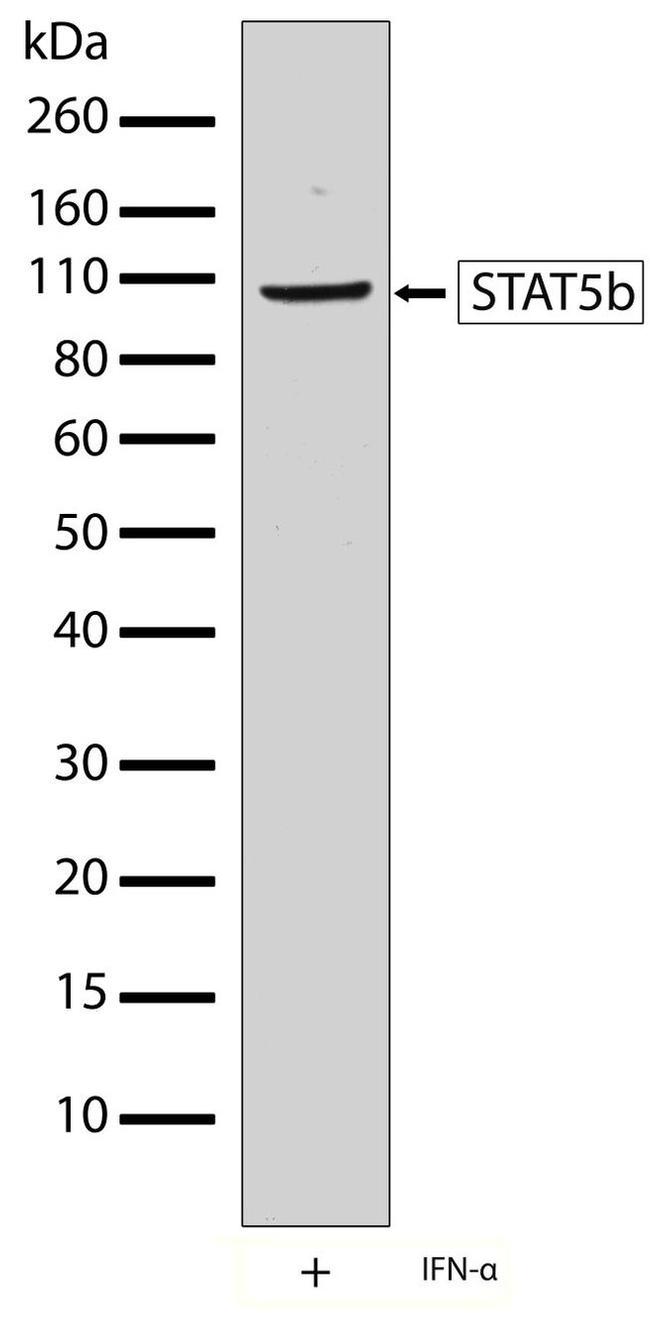 STAT5 beta Antibody in Western Blot (WB)