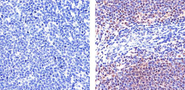 STAT6 Antibody in Immunohistochemistry (Paraffin) (IHC (P))