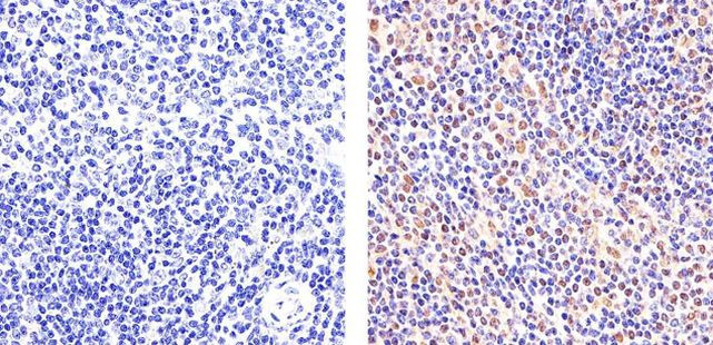 STAT6 Antibody in Immunohistochemistry (Paraffin) (IHC (P))