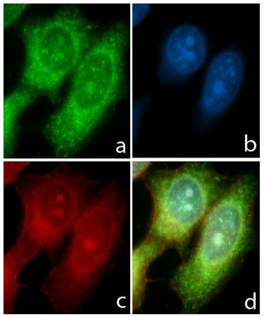 STAT6 Antibody in Immunocytochemistry (ICC/IF)