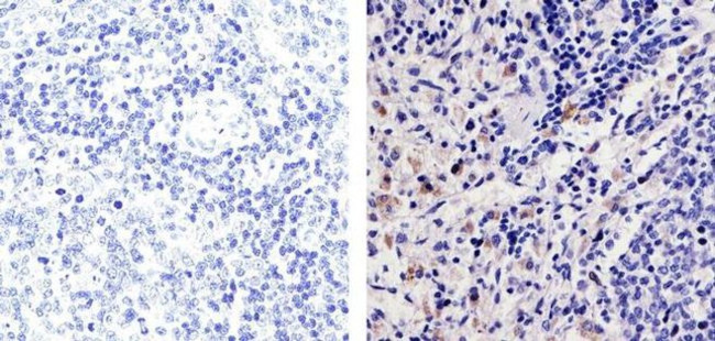 CXCL2 Antibody in Immunohistochemistry (Paraffin) (IHC (P))