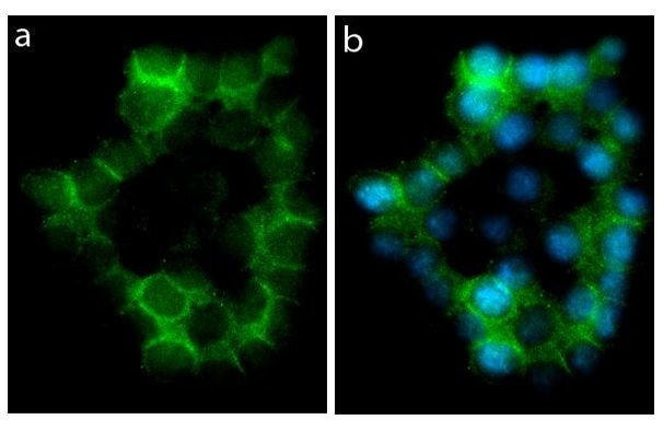 E-cadherin Antibody in Immunocytochemistry (ICC/IF)