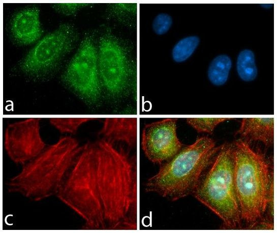 PDGFRA Antibody in Immunocytochemistry (ICC/IF)