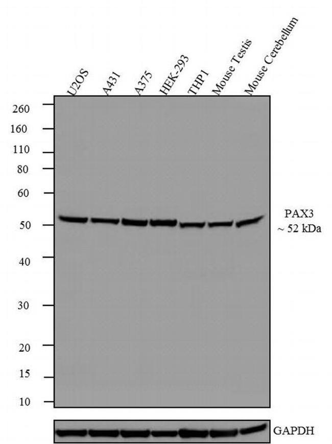 PAX3 Antibody in Western Blot (WB)