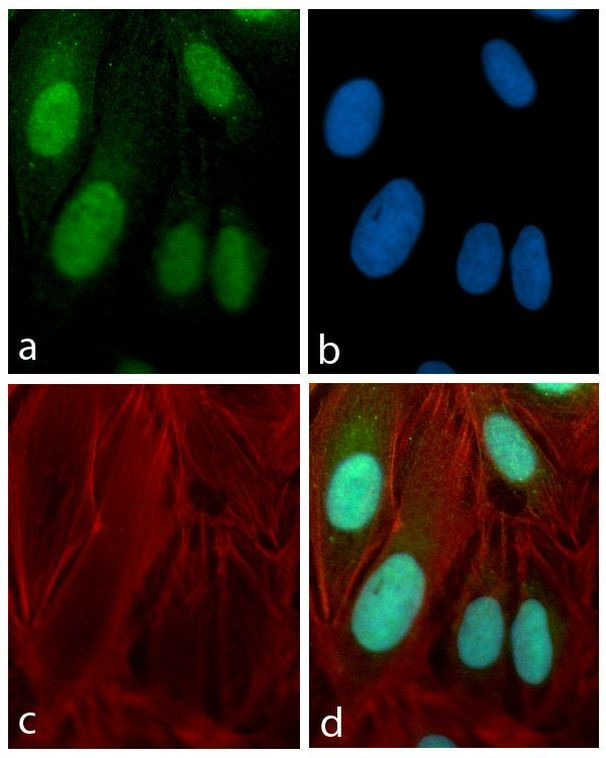 PAX3 Antibody in Immunocytochemistry (ICC/IF)