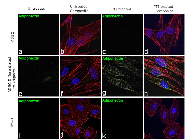 Adiponectin Antibody in Immunocytochemistry (ICC/IF)