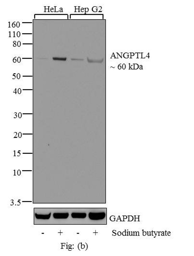 ANGPTL4 Antibody in Western Blot (WB)