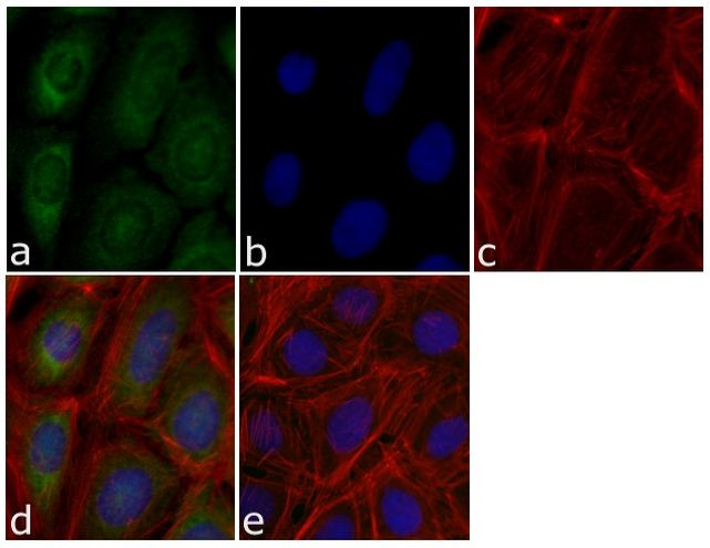 Metadherin Antibody in Immunocytochemistry (ICC/IF)