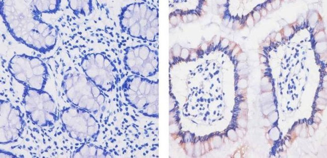 MCP-2 Antibody in Immunohistochemistry (Paraffin) (IHC (P))