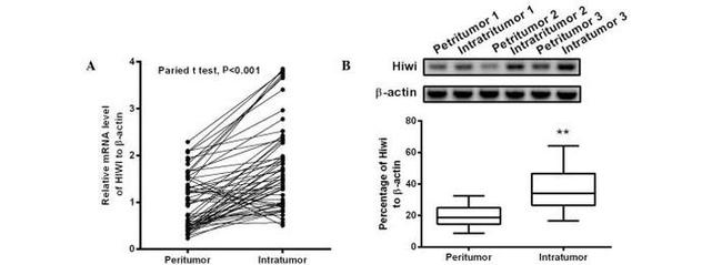 PIWIL1 Antibody in Western Blot (WB)