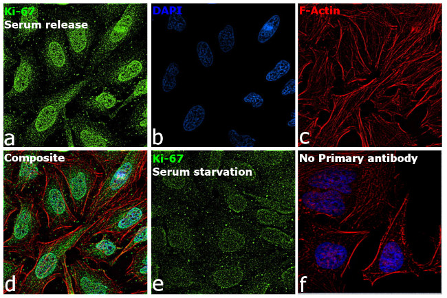 Ki-67 Antibody in Immunocytochemistry (ICC/IF)