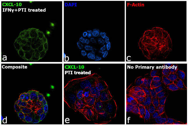 CXCL10 Antibody in Immunocytochemistry (ICC/IF)