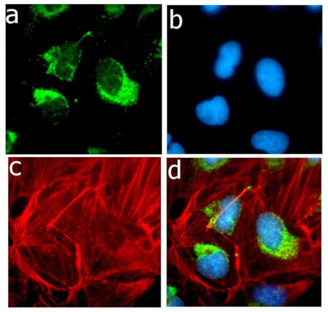 ApoA1 Antibody in Immunocytochemistry (ICC/IF)