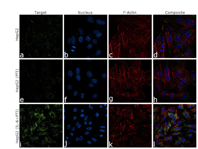 CRP Antibody in Immunocytochemistry (ICC/IF)