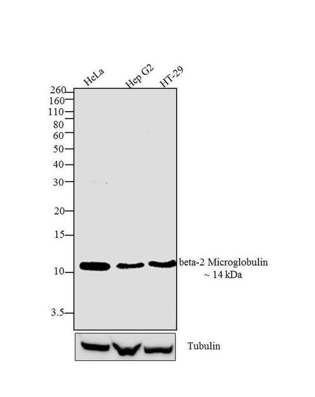 beta-2 Microglobulin Antibody in Western Blot (WB)