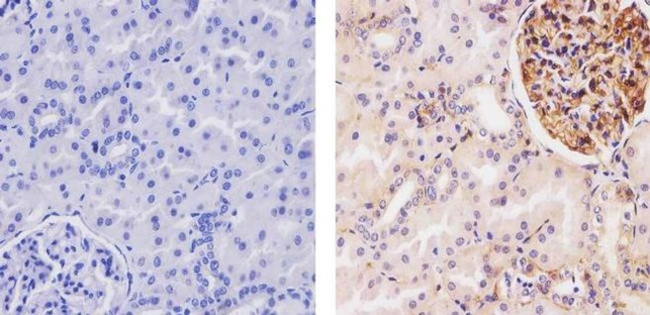 beta-2 Microglobulin Antibody in Immunohistochemistry (Paraffin) (IHC (P))