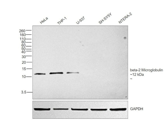 beta-2 Microglobulin Antibody