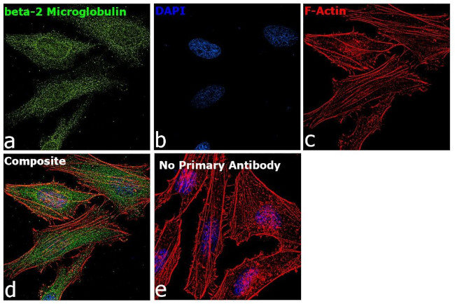 beta-2 Microglobulin Antibody in Immunocytochemistry (ICC/IF)