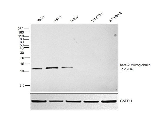 beta-2 Microglobulin Antibody in Western Blot (WB)