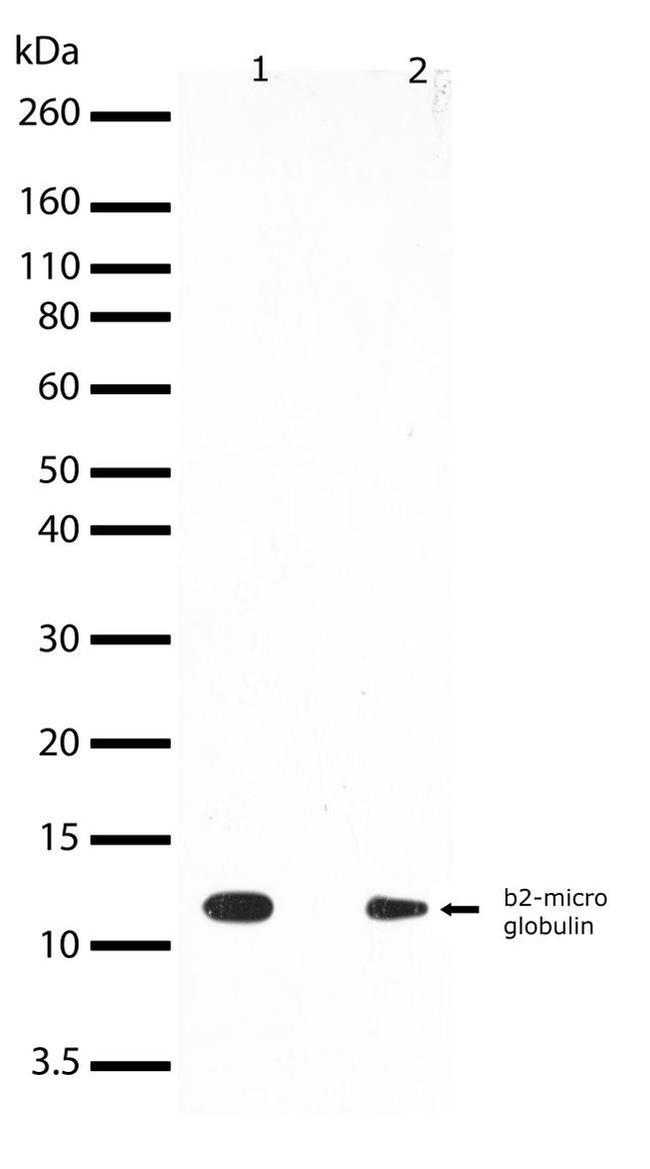 beta-2 Microglobulin Antibody in Western Blot (WB)