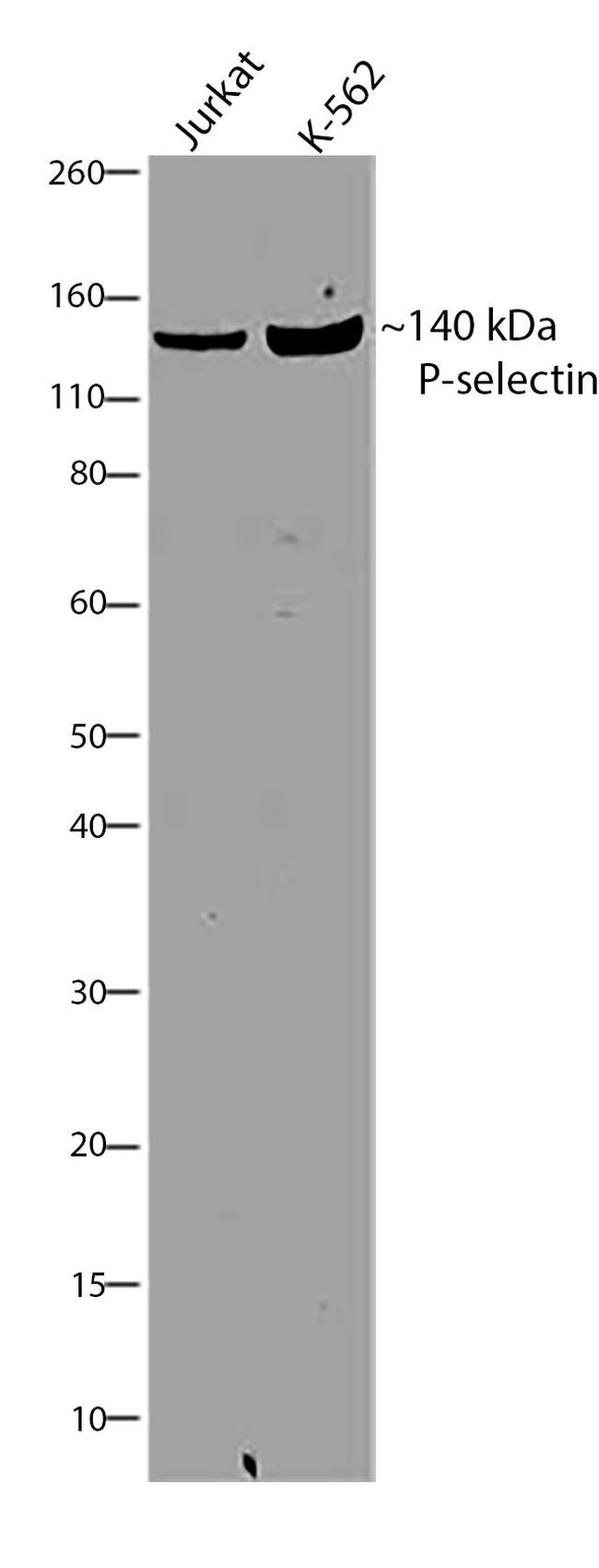 P-Selectin Antibody in Western Blot (WB)