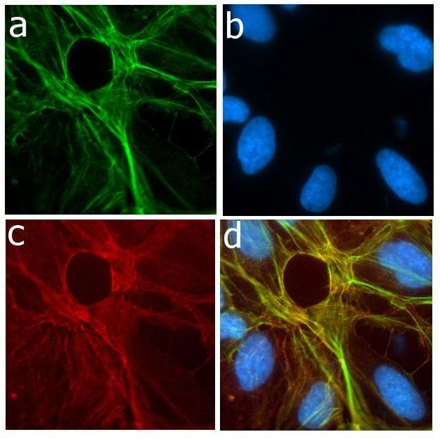 P-Selectin Antibody in Immunocytochemistry (ICC/IF)