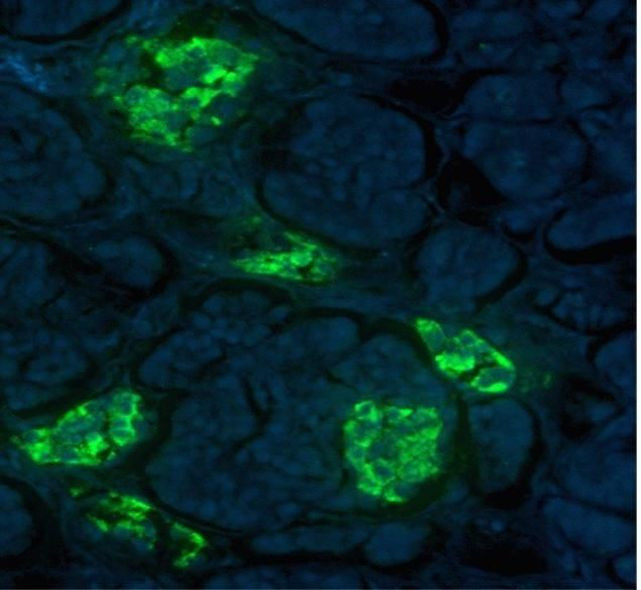 Insulin Antibody in Immunohistochemistry (IHC)