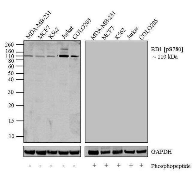 Phospho-Rb (Ser780) Antibody in Western Blot (WB)