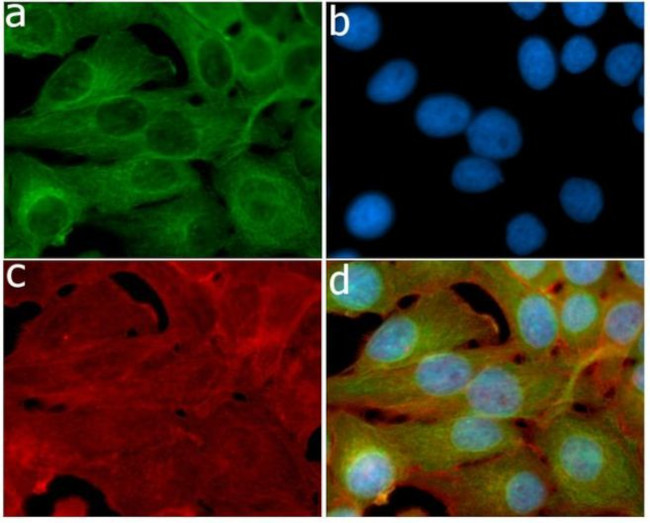 HGF Antibody in Immunocytochemistry (ICC/IF)