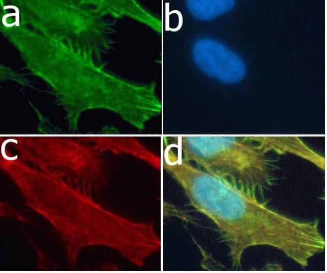 MMP3 Antibody in Immunocytochemistry (ICC/IF)