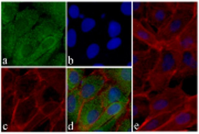 MMP3 Antibody in Immunocytochemistry (ICC/IF)