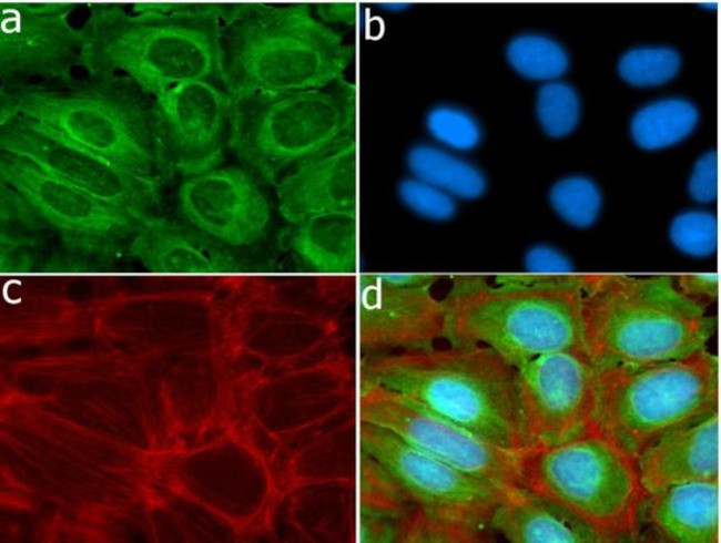 MMP13 Antibody in Immunocytochemistry (ICC/IF)