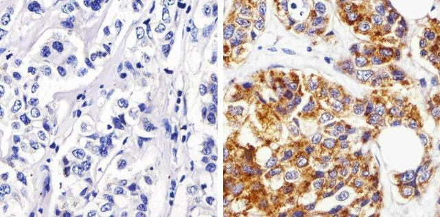 MMP13 Antibody in Immunohistochemistry (Paraffin) (IHC (P))