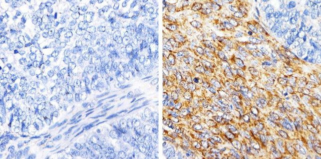 MMP13 Antibody in Immunohistochemistry (Paraffin) (IHC (P))