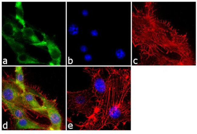 ACTH Antibody in Immunocytochemistry (ICC/IF)