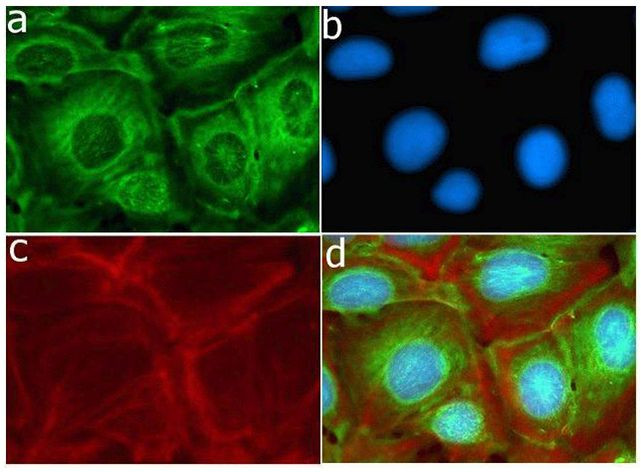 MMP16 Antibody in Immunocytochemistry (ICC/IF)