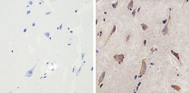 MMP16 Antibody in Immunohistochemistry (Paraffin) (IHC (P))