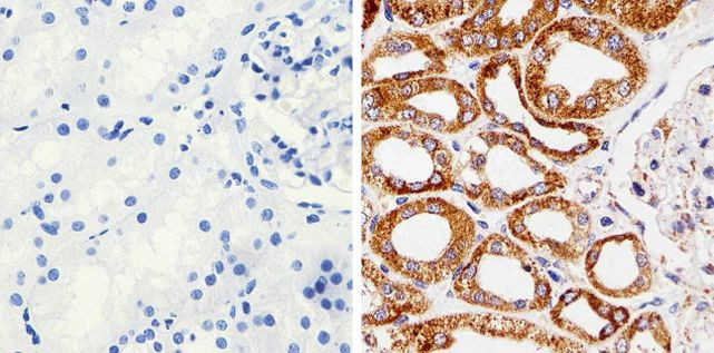 MMP16 Antibody in Immunohistochemistry (Paraffin) (IHC (P))