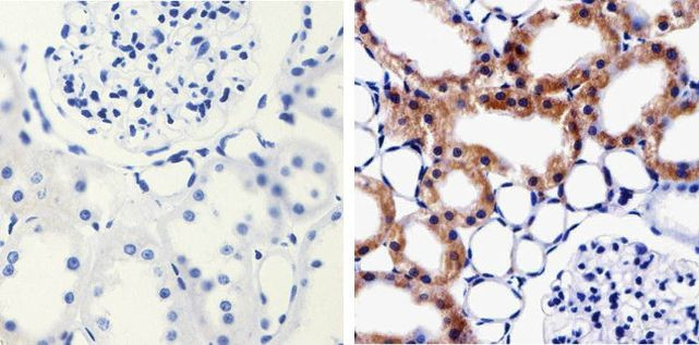 MMP16 Antibody in Immunohistochemistry (Paraffin) (IHC (P))