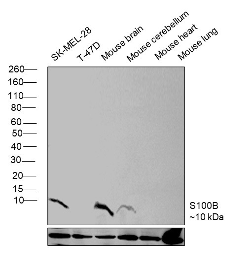 S100B Antibody in Western Blot (WB)