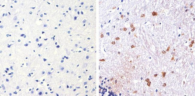 S100B Antibody in Immunohistochemistry (Paraffin) (IHC (P))