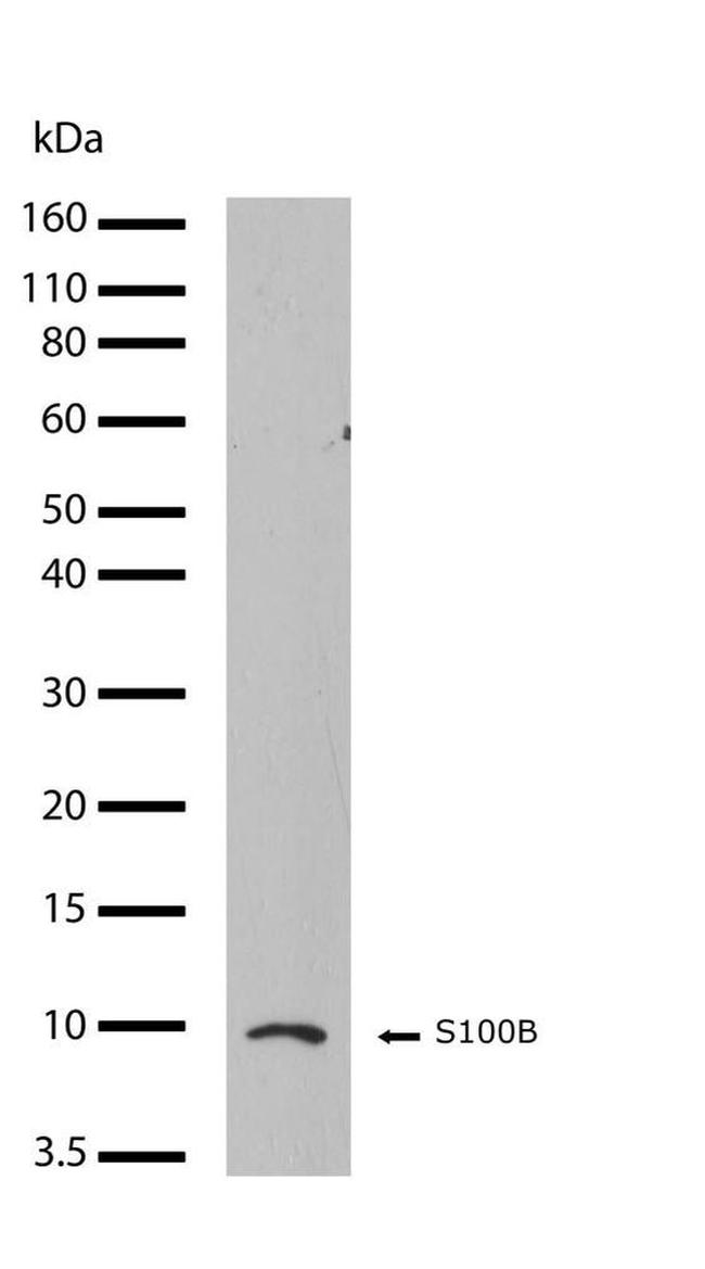 S100B Antibody in Western Blot (WB)