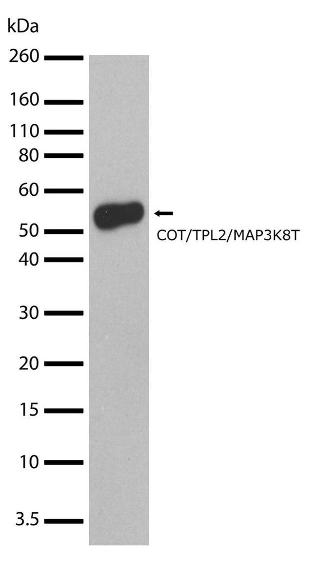 TPL2 Antibody in Western Blot (WB)