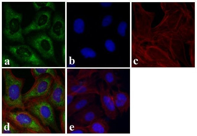 S6 Antibody in Immunocytochemistry (ICC/IF)