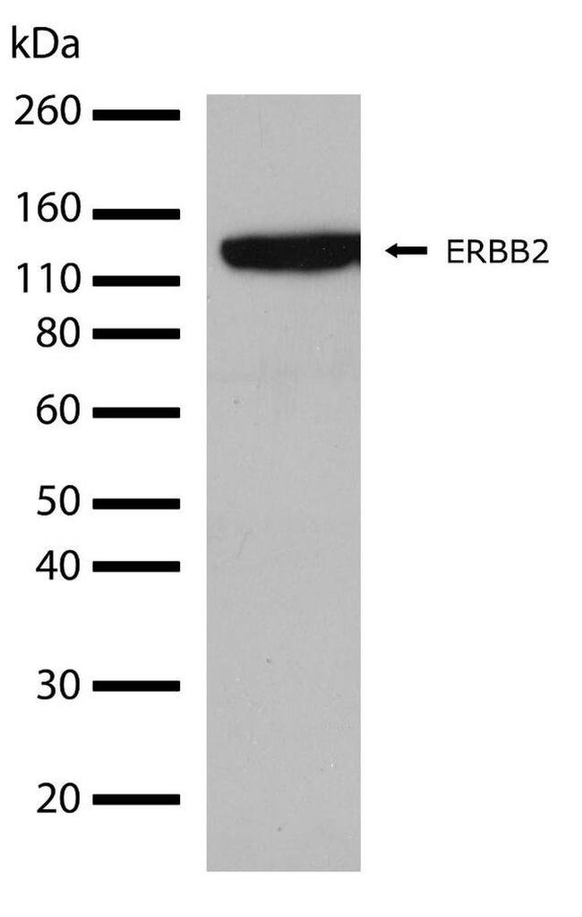 ErbB2 (HER-2) Antibody in Western Blot (WB)