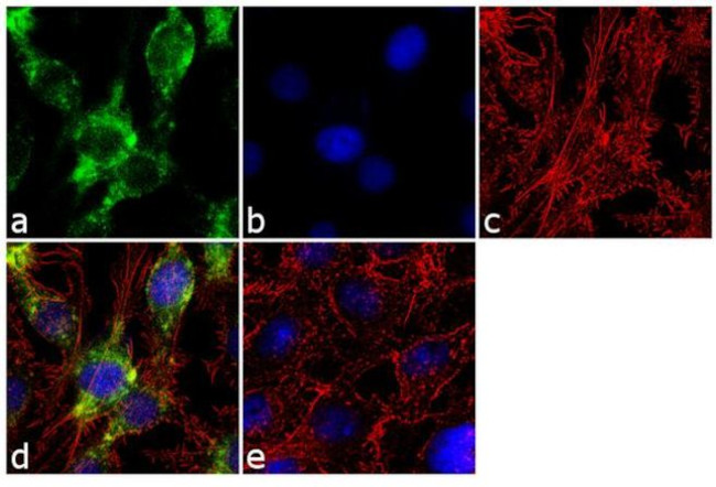 SHH Antibody in Immunocytochemistry (ICC/IF)