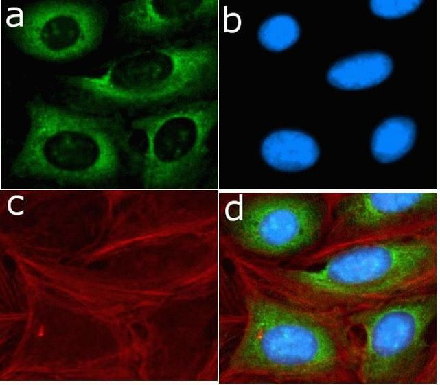 SHH Antibody in Immunocytochemistry (ICC/IF)