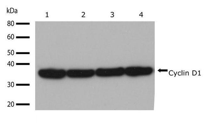 Cyclin D1 Antibody in Western Blot (WB)