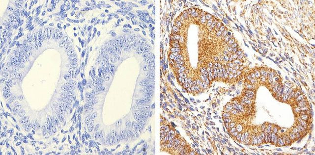 Alpha-Smooth Muscle Actin Antibody in Immunohistochemistry (Paraffin) (IHC (P))