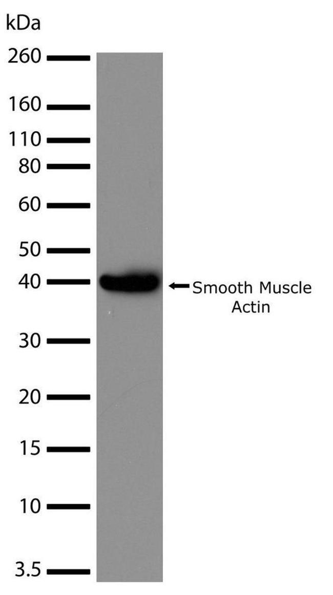 Alpha-Smooth Muscle Actin Antibody in Western Blot (WB)